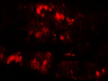 SLC29A3/ENT3 Antibody
