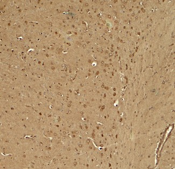 TWIK1/KCNK1 Antibody