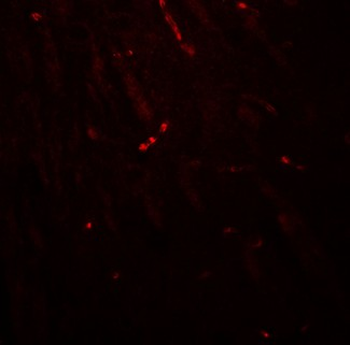 TWIK1/KCNK1 Antibody