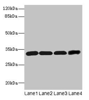 CD20 Antibody