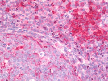 TNM/Teneurin-1 Antibody