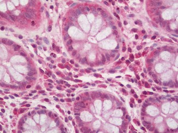 NPHP1/Nephronophthisis Antibody