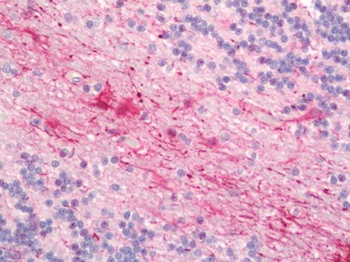 CYBB/NOX2/gp91phox Antibody