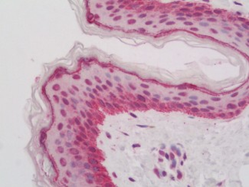 GATA3 Antibody