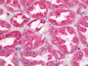 CANX/Calnexin Antibody