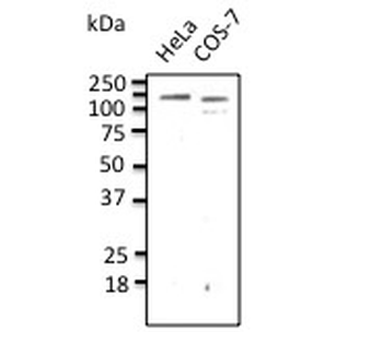 CDH1/E Cadherin Antibody