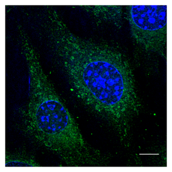 RAB5A/RAB5 Antibody