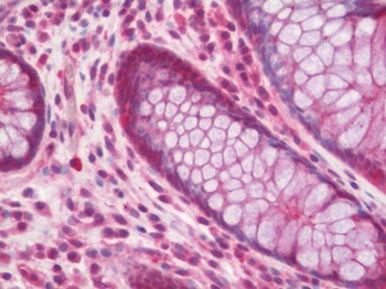 ACHE/Acetylcholinesterase Antibody