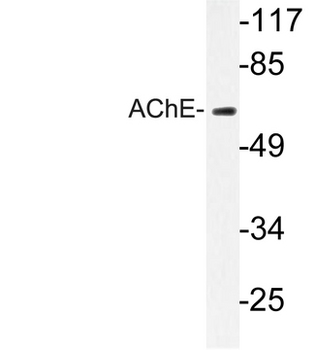 ACHE/Acetylcholinesterase Antibody