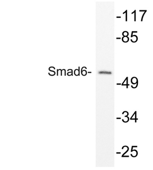 SMAD6 Antibody