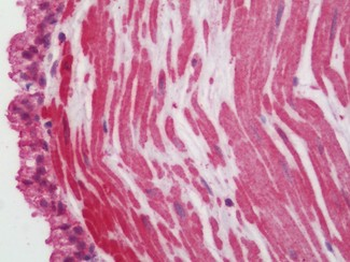 Endothelin 3/EDN3 Antibody