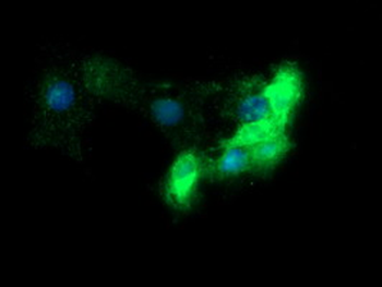 FCGR1A/CD64 Antibody