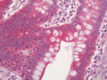 NFE2L2/NRF2 Antibody