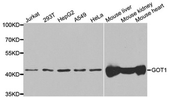Aspartate Aminotransferase Antibody