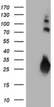JCHAIN/Ig J Chain Antibody