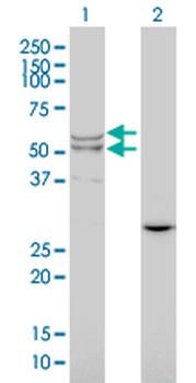 LIPA/Lysosomal Acid Lipase Antibody