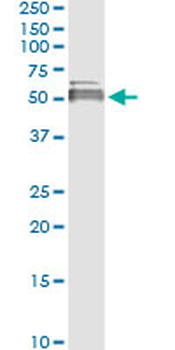 LIPA/Lysosomal Acid Lipase Antibody