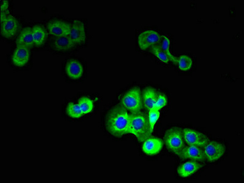 STEAP1/STEAP Antibody