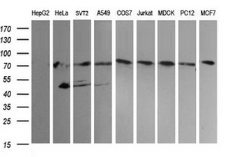 NCAM/CD56 Antibody