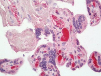 Complement C3 Antibody