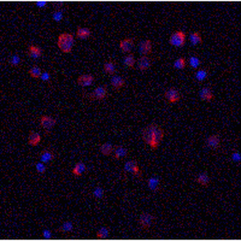 IL11 Antibody