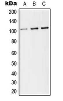 THBD/CD141/Thrombomodulin Antibody