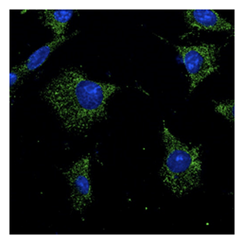 RAB7A/RAB7 Antibody