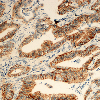 TUSC3 Antibody