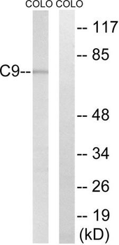 Complement C9 Antibody