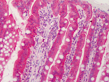 C1QTNF6/CTRP6 Antibody