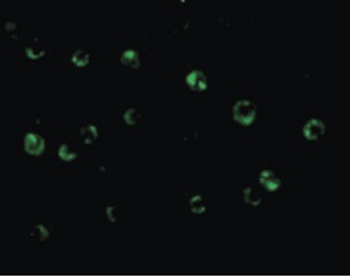 C1QTNF6/CTRP6 Antibody
