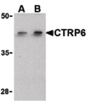 C1QTNF6/CTRP6 Antibody
