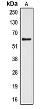 CYP4Z1 Antibody