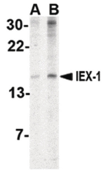 IER3/IEX-1 Antibody