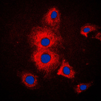 KRT19/CK19/Cytokeratin 19 Antibody