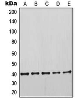 KRT19/CK19/Cytokeratin 19 Antibody