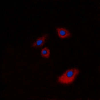 KRT20/CK20/Cytokeratin 20 Antibody