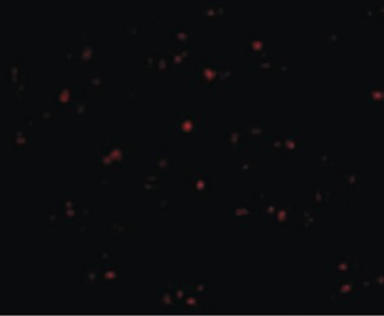 IFN Beta/Interferon Beta Antibody