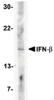 IFN Beta/Interferon Beta Antibody