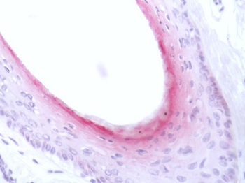 KRT84/Keratin 84/KRTHB4 Antibody