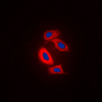 RAB31 Antibody