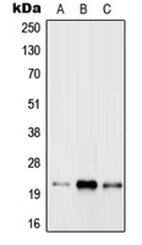 RAB31 Antibody