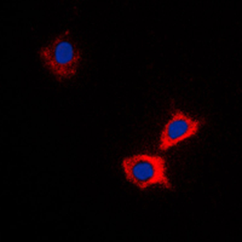 ABCB10 Antibody
