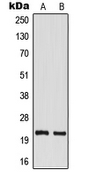 TM2D1/BBP Antibody