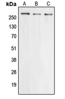 CACNA1E/Cav2.3 Antibody