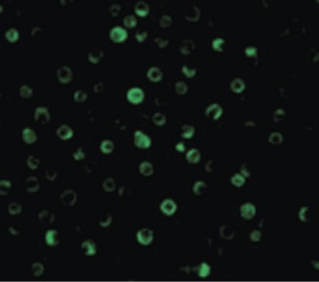 IL22RA1/IL22R Antibody