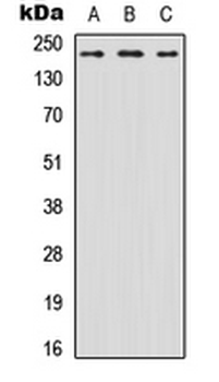 SCN8A/Nav1.6 Antibody