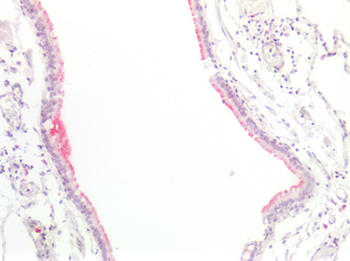 FLG/Filaggrin Antibody