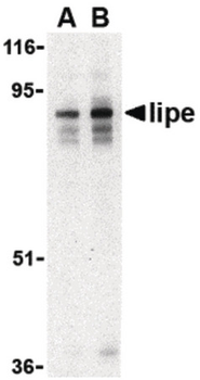 LIPE/HSL Antibody