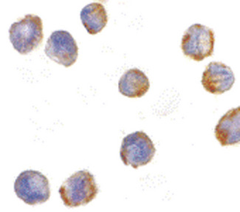 MTBP/Mdm2-Binding Protein Antibody